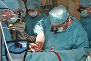 chirurgiczne leczenie żylaków miednicy