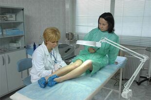 Laseroterapia żylaków nóg