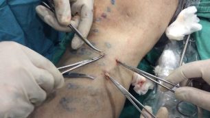 chirurgia naczyń